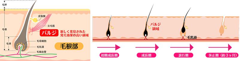 ハイブリット脱毛