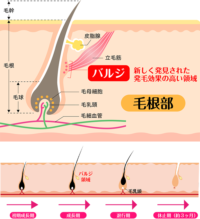 ハイブリット脱毛