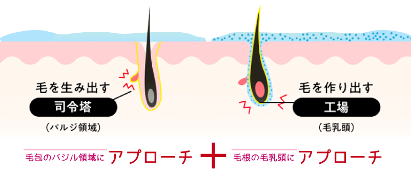 ハイブリット脱毛